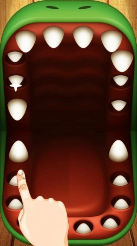 鳄鱼牙医挑战游戏完整版下载-鳄鱼牙医挑战手游汉化版下载v1.0