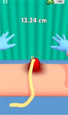 挤疙瘩挑战游戏