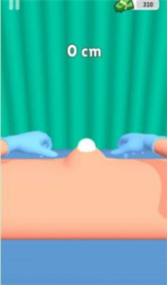 挤疙瘩挑战游戏