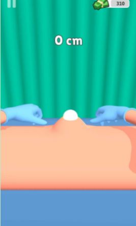 粉刺挤压游戏下载-粉刺挤压安卓版下载v1.0.0