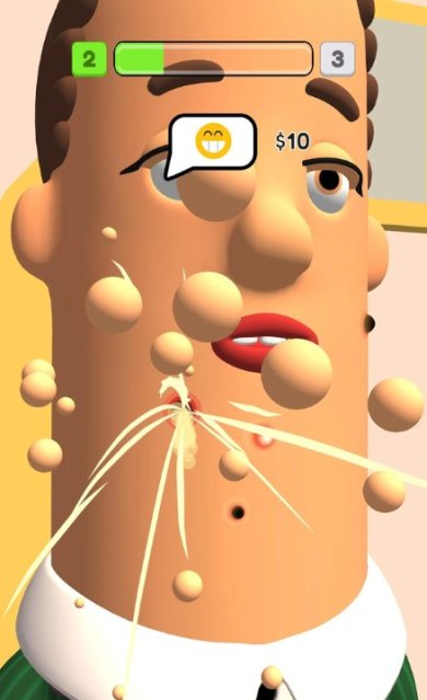 挤痘痘达人官方正版