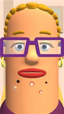 我爱挤痘痘手游