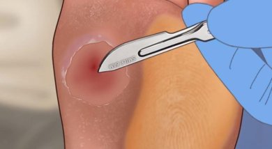 修脚足疔模拟器游戏下载-修脚足疔模拟器手机版下载v1.0