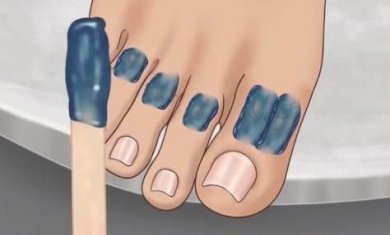 修脚足疔模拟器中文安卓版下载-修脚足疔模拟器完整版下载v1.0