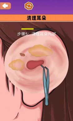 沉浸式采耳修脚游戏下载-沉浸式采耳修脚手游下载v1.0