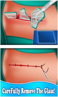 手鼻子心脏手术中文版下载-手鼻子心脏手术下载v1.2.6