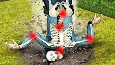 骨折模拟器无限金币版下载-骨折模拟器破解版下载v0.14.1